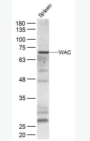 Anti-WAC antibody-WAC蛋白抗体,WAC