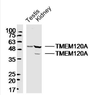 Anti-TMEM120A antibody-跨膜蛋白120A抗体,TMEM120A