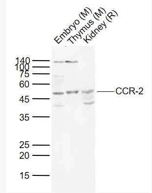 Anti-CCR-2 antibody-細胞表面趨化因子受體2抗體,CCR-2