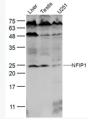 Anti-NFIP1 antibody-乳腺癌相關(guān)蛋白SGA 1M抗體,NFIP1