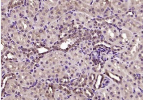 Anti-MED19/LCMR1 antibody-肺癌转移相关蛋白1抗体,MED19/LCMR1