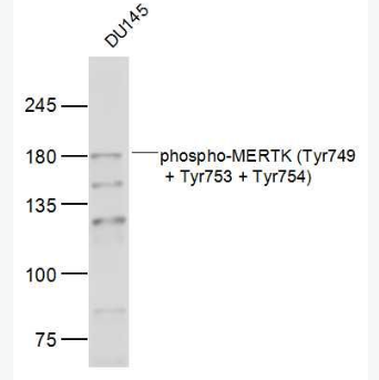 Anti-phospho-MERTK (Tyr749 + Tyr753 + Tyr754) antibody-磷酸化c-mer原癌基因酪氨酸激酶抗体,phospho-MERTK (Tyr749 + Tyr753 + Tyr754)