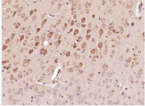 Anti-SMCR7 antibody-SMCR7蛋白抗體,SMCR7