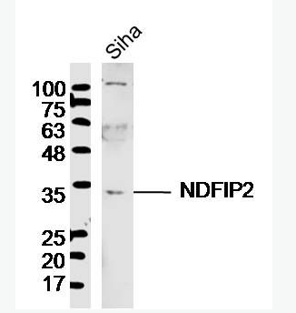 Anti-NDFIP2 antibody-NDFIP2抗体,NDFIP2