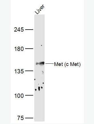 Anti-MET antibody-肝细胞生长因子受体抗体,MET