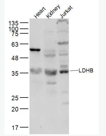 Anti-LDHB antibody-乳酸脱氢酶抗体,LDHB