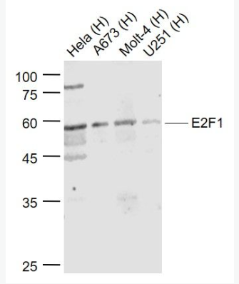 Anti-E2F1 antibody-转录因子E2F-1抗体,E2F1