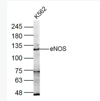 Anti-eNOSantibody-一氧化氮合成酶-3（内皮型）抗体,eNOS