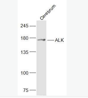 Anti-ALK antibody-間變型淋巴瘤激酶抗體,ALK