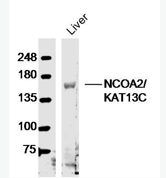 Anti-NCOA2/KAT13C  antibody-类固醇受体激活蛋白2抗体,NCOA2/KAT13C