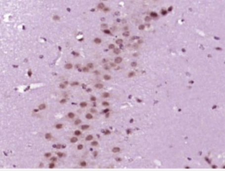 Anti-ABCG1 antibody-三磷酸腺苷结合盒亚家族G1抗体,ABCG1