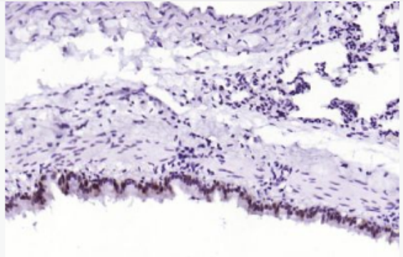 Anti-CATSPER antibody-阳离子通道精子相关蛋白1抗体,CATSPER