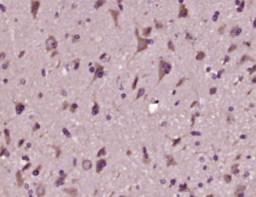 Anti-Aβ1-42 (CT) antibody-β淀粉樣肽（C端）抗體,Aβ1-42 (CT)