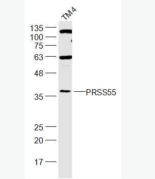 Anti-PRSS55 antibody-絲氨酸蛋白酶55抗體,PRSS55