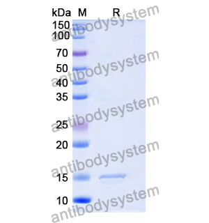 抗 Human CNR1/CB1 納米抗體 (SAA1274)(RHD46201),Anti-Human CNR1/CB1 Nanobody (SAA1274)