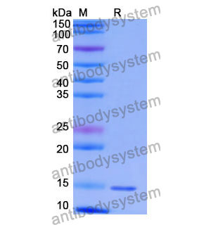 抗 Human TRIM28 纳米抗体 (SAA1235)(RHG46502),Anti-Human TRIM28 Nanobody (SAA1235)