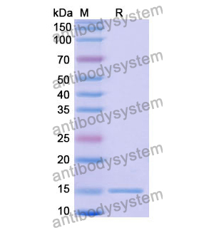 抗 Human GFAP 纳米抗体 (SAA1221)(RHD03101),Anti-Human GFAP Nanobody (SAA1221)