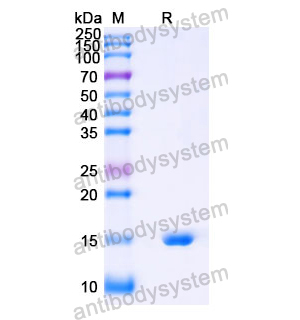 抗 Human SOST 纳米抗体 (SAA1265)(RHJ48701),Anti-Human SOST Nanobody (SAA1265)