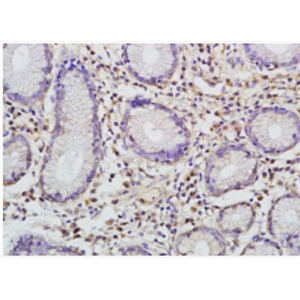 Anti-I-309/CCL1 antibody-嗜酸粒细胞趋化蛋白CCL1抗体