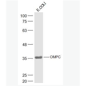 Anti-OMPC antibody-大肠杆菌外膜孔道蛋白C抗体