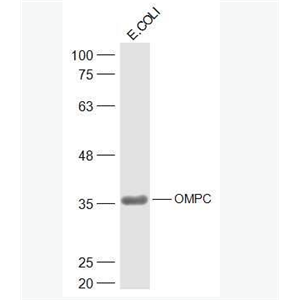 Anti-OMPC antibody-大肠杆菌外膜孔道蛋白C抗体,OMPC