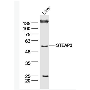 Anti-STEAP3 antibody-前列腺跨膜上皮3抗原抗体