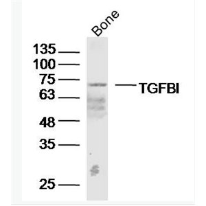 Anti-TGFBI antibody-角膜上皮蛋白TGFBI抗体