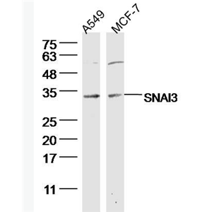 Anti-SNAI3 antibody-锌指蛋白293抗体