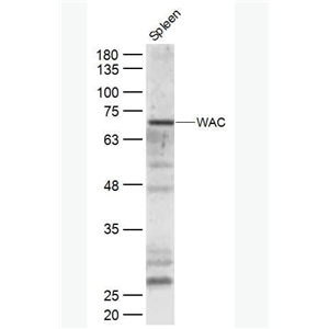Anti-WAC antibody-WAC蛋白抗体