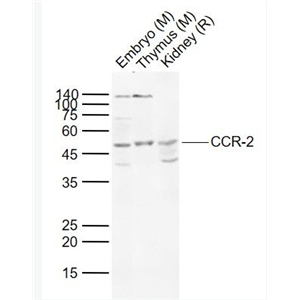 Anti-CCR-2 antibody-细胞表面趋化因子受体2抗体