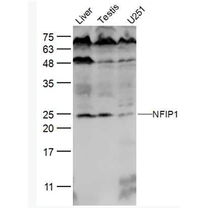 Anti-NFIP1 antibody-乳腺癌相关蛋白SGA 1M抗体