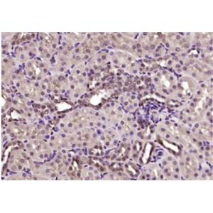 Anti-MED19/LCMR1 antibody-肺癌转移相关蛋白1抗体