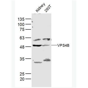 Anti-VPS4B antibody-液泡蛋白分选蛋白4B抗体,VPS4B