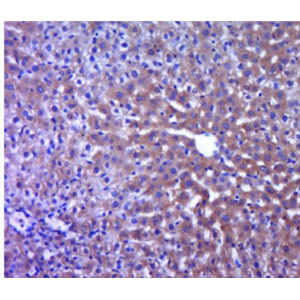 Anti-TNNC2 antibody-肌鈣蛋白C2抗體