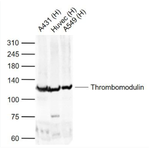 Anti-Thrombomodulin antibody-血栓调节蛋白抗体