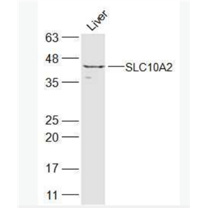 Anti-SLC10A2  antibody-顶膜钠依赖性胆盐转运体蛋白抗体