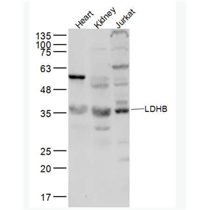 Anti-LDHB antibody-乳酸脱氢酶抗体