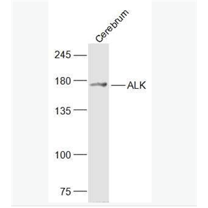 Anti-ALK antibody-间变型淋巴瘤激酶抗体