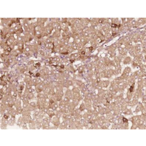 Anti-HBEGF antibody-肝素结合性表皮生长因子抗体,HBEGF