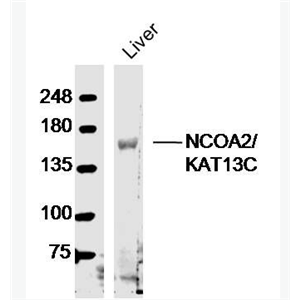 Anti-NCOA2/KAT13C  antibody-类固醇受体激活蛋白2抗体,NCOA2/KAT13C