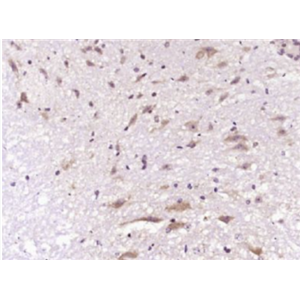Anti-Neutrophil Elastase  antibody-中性粒细胞弹性蛋白酶ELANE抗体,Neutrophil Elastase