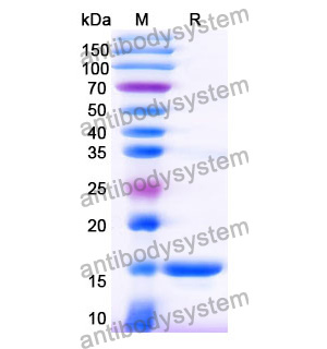 抗 General AX/Amoxicillin 納米抗體 (SAA1371)(RGK33102),Anti-General AX/Amoxicillin Nanobody (SAA1371)