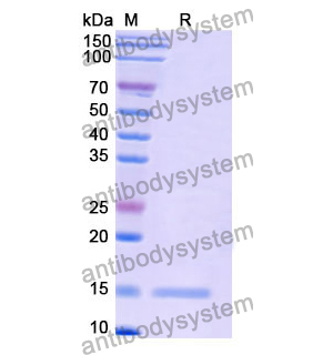 抗 Human CD339/JAG1 納米抗體 (SAA1285)(RHF68301),Anti-Human CD339/JAG1 Nanobody (SAA1285)