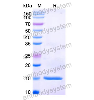 抗 Human C4A 纳米抗体 (SAA0907)(RHC45302),Anti-Human C4A Nanobody (SAA0907)