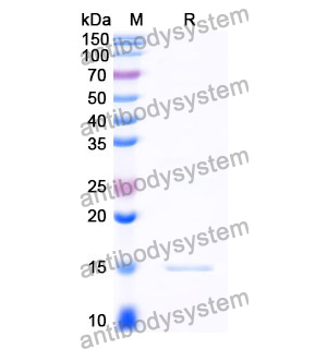 抗 Clostridium botulinum BoNT/B 纳米抗体 (SAA0940)(RXX10204),Anti-Clostridium botulinum BoNT/B Nanobody (SAA0940)