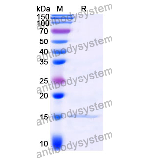 抗 Clostridium botulinum BoNT/B 纳米抗体 (SAA0941)(RXX10205),Anti-Clostridium botulinum BoNT/B Nanobody (SAA0941)