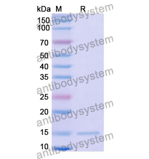 抗 Human LMO2 纳米抗体 (SAA1172)(RHD68301),Anti-Human LMO2 Nanobody (SAA1172)