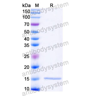 抗 Castor bean Ricin 納米抗體 (SAA1088)(RZZ01815),Anti-Castor bean Ricin Nanobody (SAA1088)