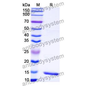 Anti-HCMV/HHV5 HHRF3/US28 Nanobody (SAA1107)