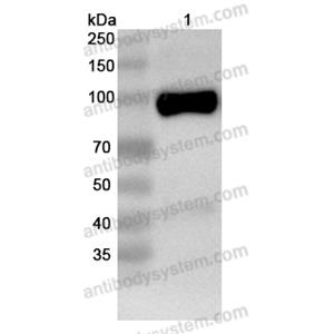 抗体：Human GRIN1/NMDAR1 Antibody (N308/48R) RHG05302